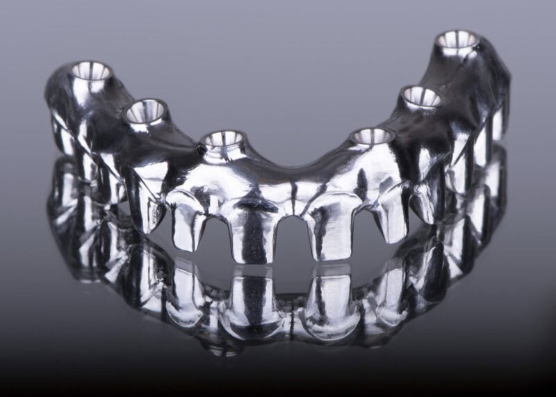 CAD:CAM-gefrästes Titangerüst – Individuell gefertigter Implantatsteg für festsitzende Prothese