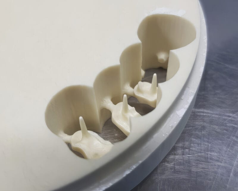 Inlay-Core aus Glasfaser – Innovative Lösung für eine widerstandsfähige, ästhetische und biokompatible Zahnrestauration 3
